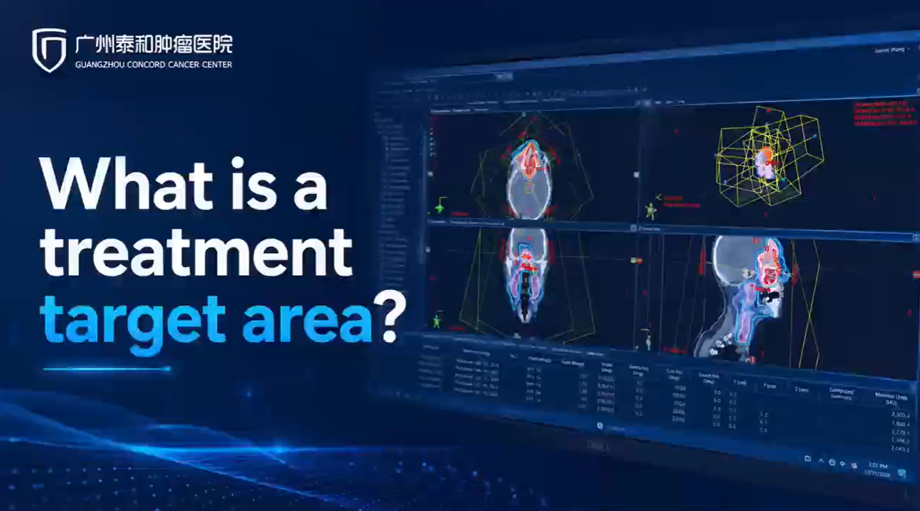 What Is a Treatment Target Area? video thumbnail